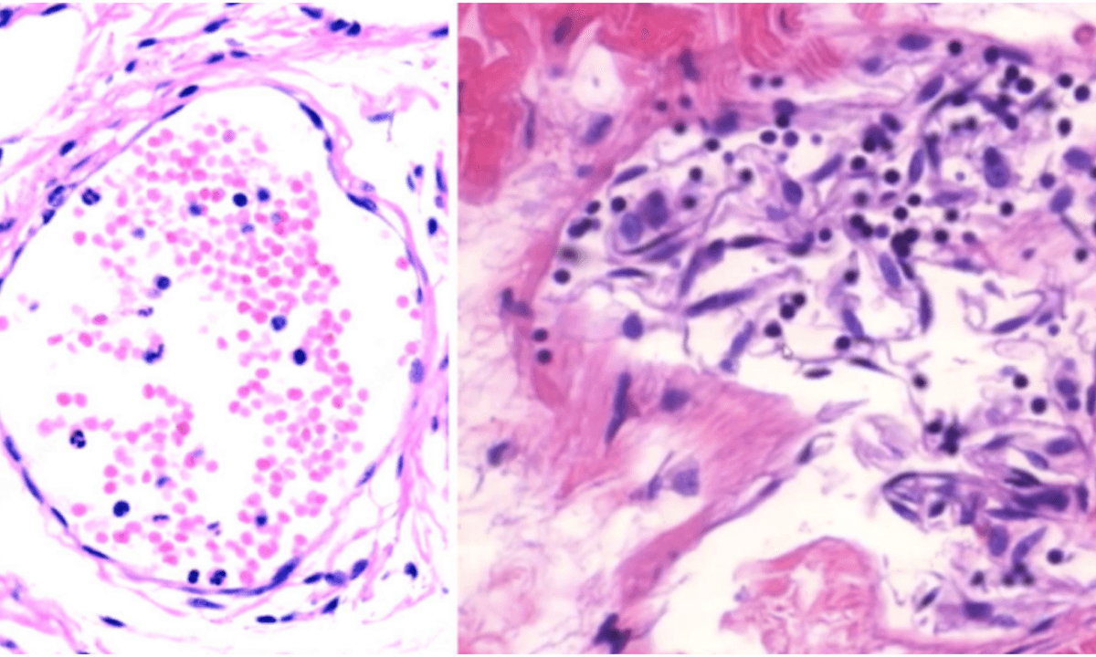 ‘Irrefutable Proof’ Study on mRNA Vaccines Causing Damage: Doctors Respond to WHO Fact-Checking Branch