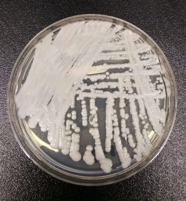CDC Confirms More Than 7,700 Cases of Multidrug-Resistant Fungus in 30 States