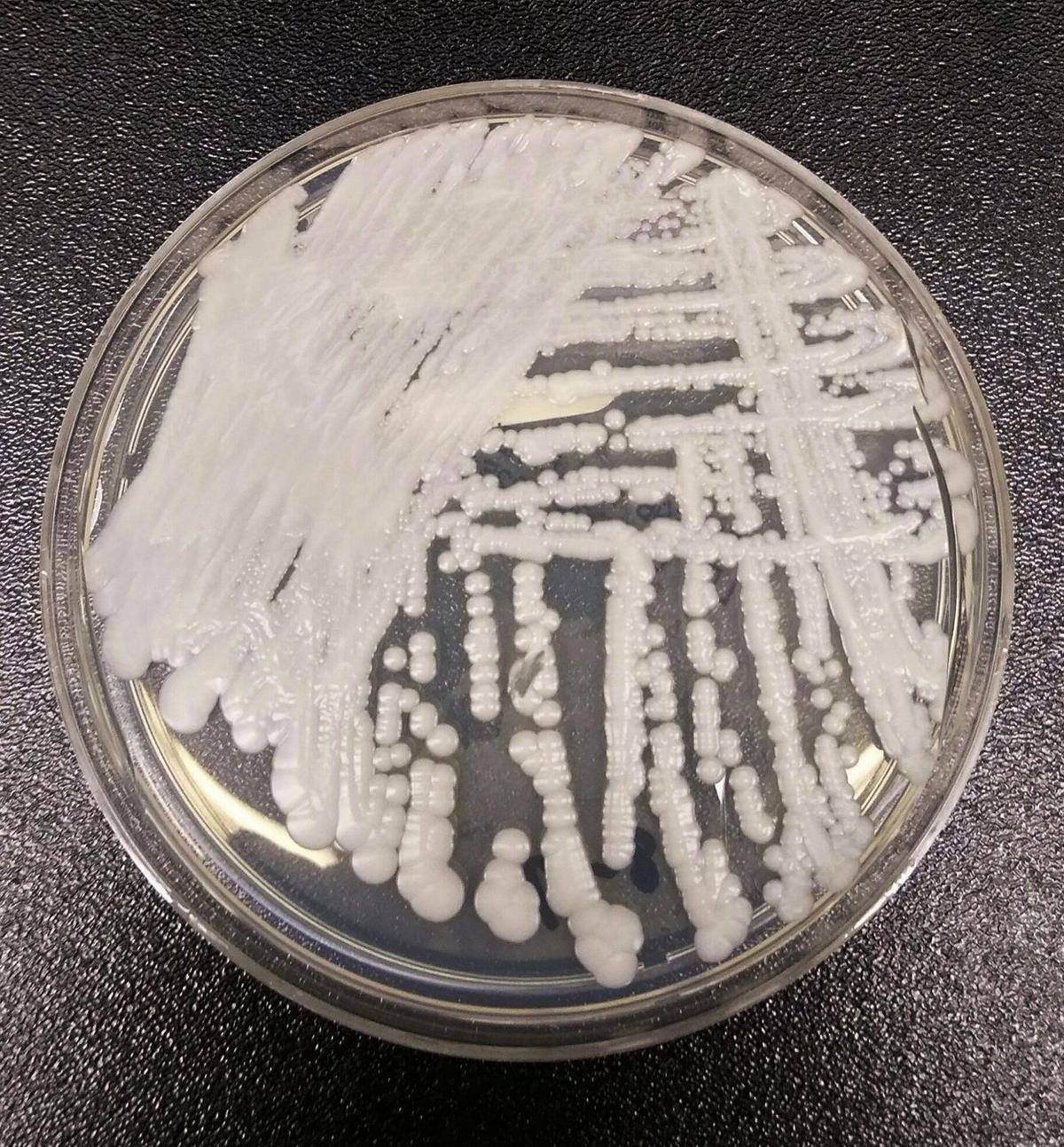 CDC Confirms More Than 7,700 Cases of Multidrug-Resistant Fungus in 30 States thumbnail