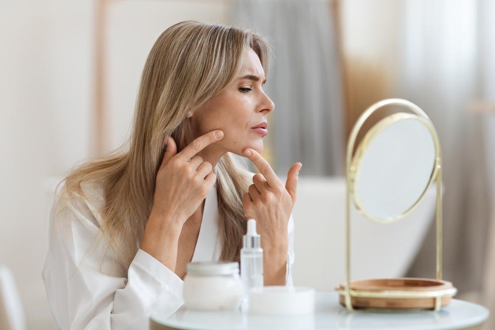 Acne Breakout Location Corresponds to Other Health Conditions—Here’s What to Know