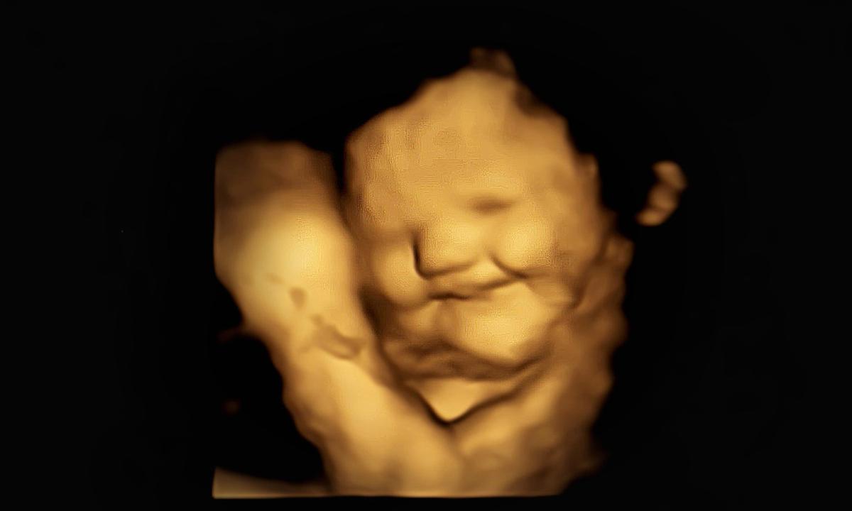 Babies in the Womb Smile When Their Moms Eat Carrot but Cry Over Kale Flavor, UK Study Finds