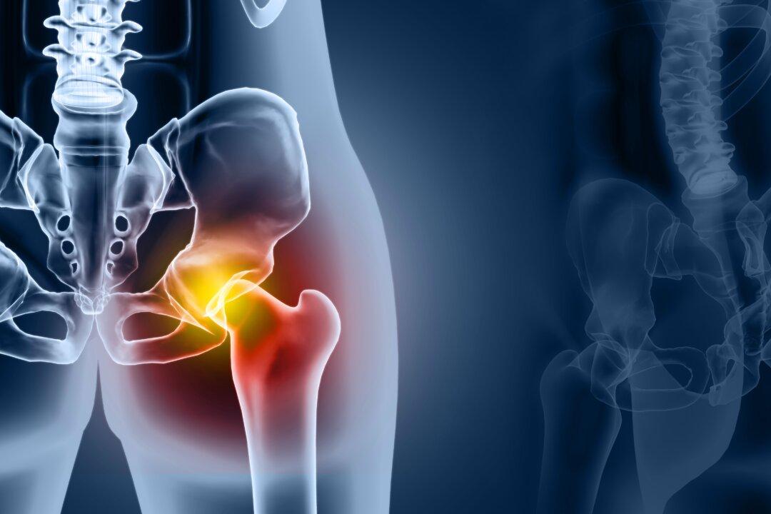 Osteoarthritis Has Doubled in the Last 50 Years