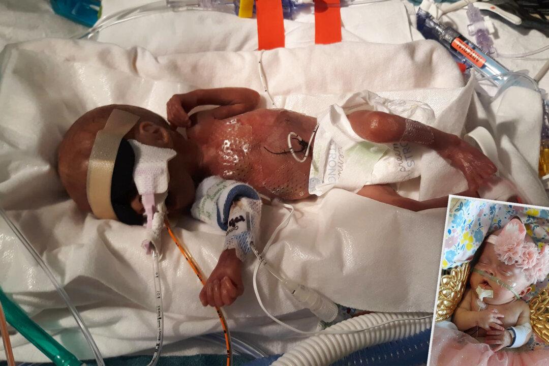 ‘She Is a Blessing From Above’: Baby Born at 22 Weeks Continues to Defy Odds