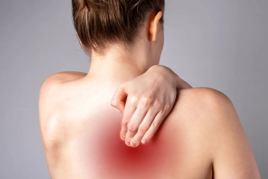 Pinched Nerve in Shoulder Blade: Causes, Symptoms, Treatments, and Exercises