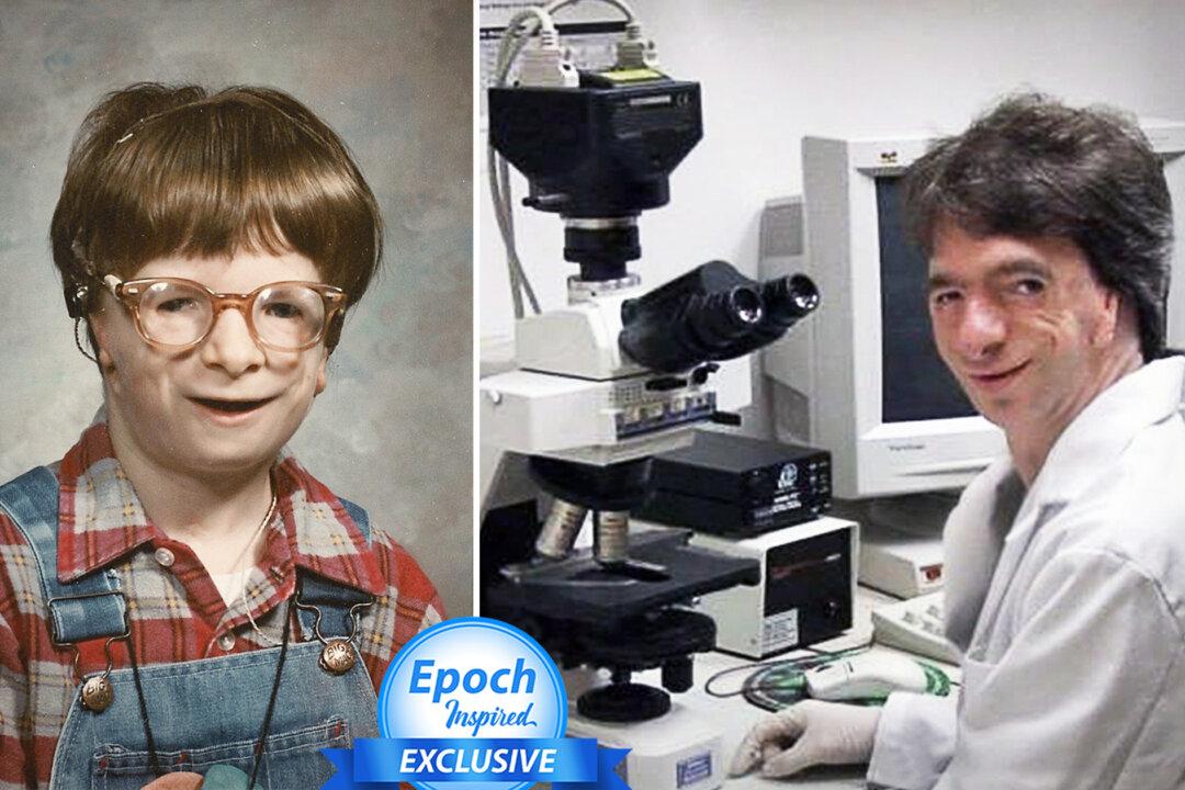 Boy With Rare Facial Deformities Was Given Up by His Parents, Grows Up to Earn PhD in Craniofacial Science
