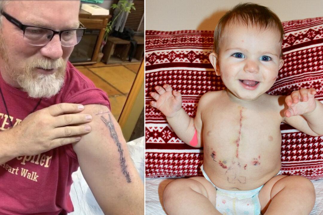 ‘The Deepest Love’: Devoted Grandpa Tattoos Grandson’s Open Heart Surgery Scar on His Arm