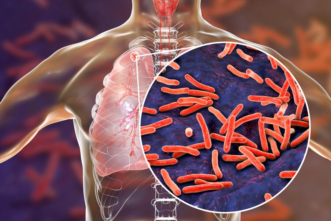 Federal Government Commits 17 Million to Fight Tuberculosis in Asia-Pacific