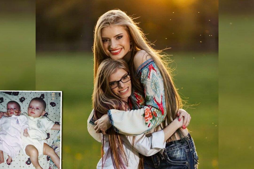 Identical Twin With Dwarfism Shares Special Bond With Protective Sister: ‘She’s My Best Friend’