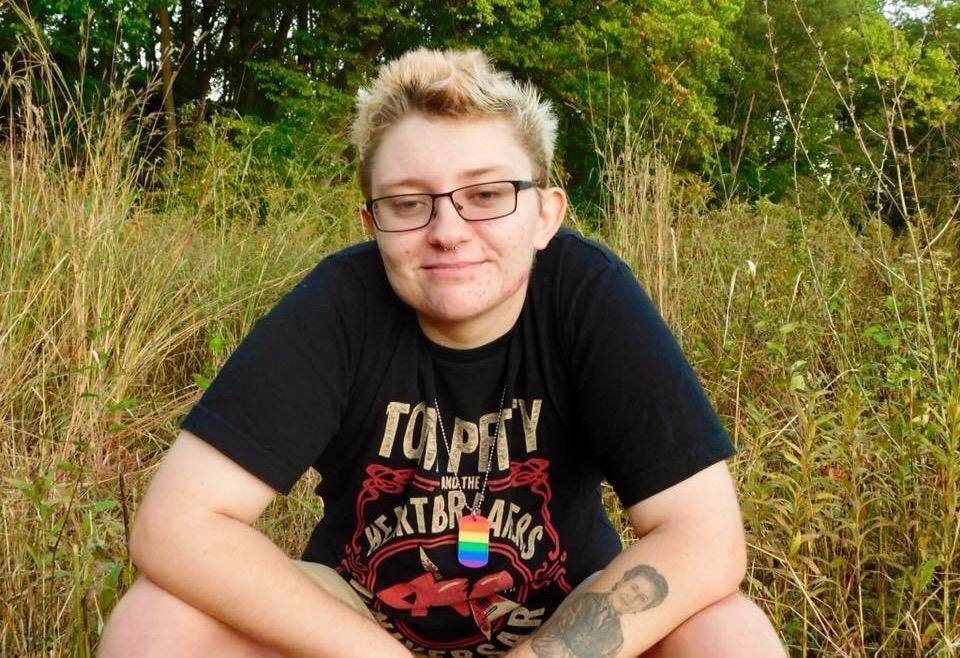 Laura Becker, at 20, two months after her double mastectomy. (Courtesy of Laura Becker)