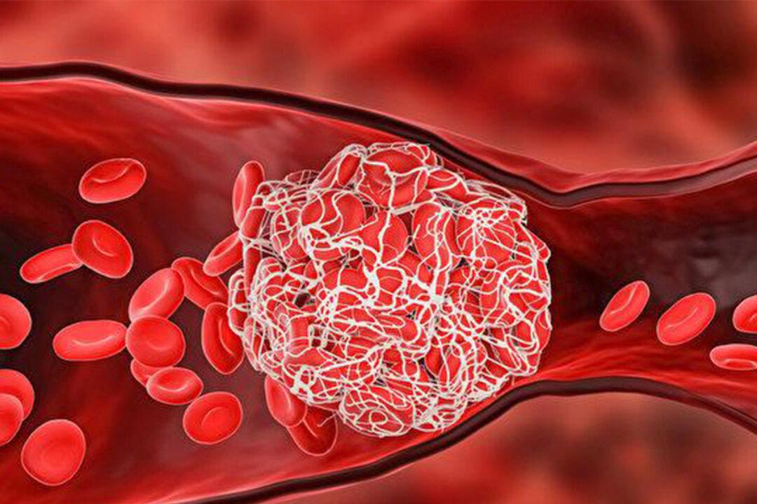 Reduce Risk of Blood Clots After COVID-19 or Vaccination With 4 Habits