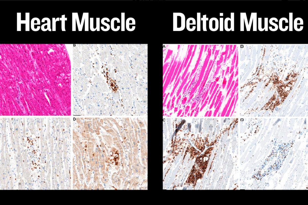 Found Dead at Home After COVID-19 Vaccination