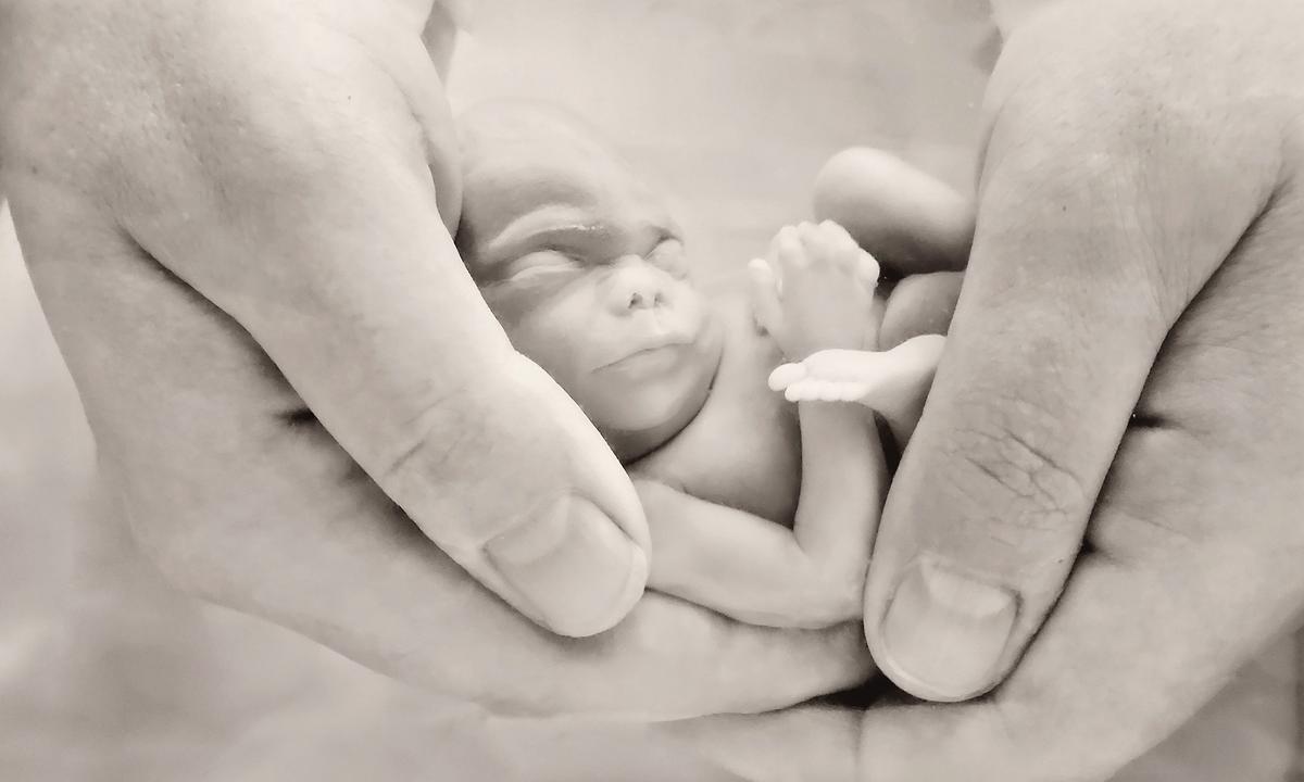 Grieving Mom’s ‘Underwater Photos’ Let Her See 18-Week Miscarried Baby With Amazing Clarity