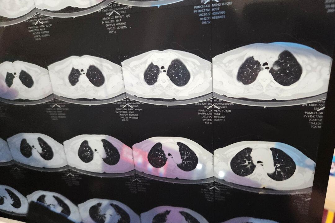 Accounts of ‘White Lung’ Flood Chinese Social Media Amid COVID Spike