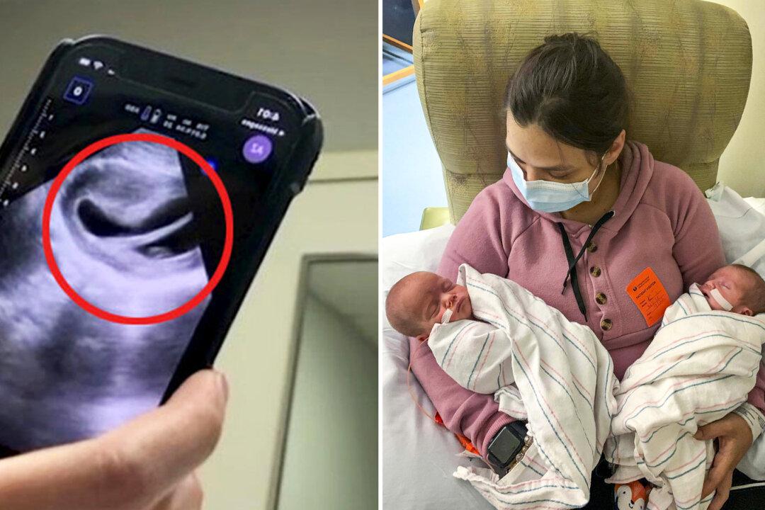Mom With Heart-Shaped Uterus Defies the Odds to Give Birth to One-in-500 Million Twins and They’re Now 16 Months Old
