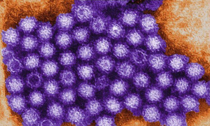 Norovirus Cases Are on the Rise Across US: What You Need to Know