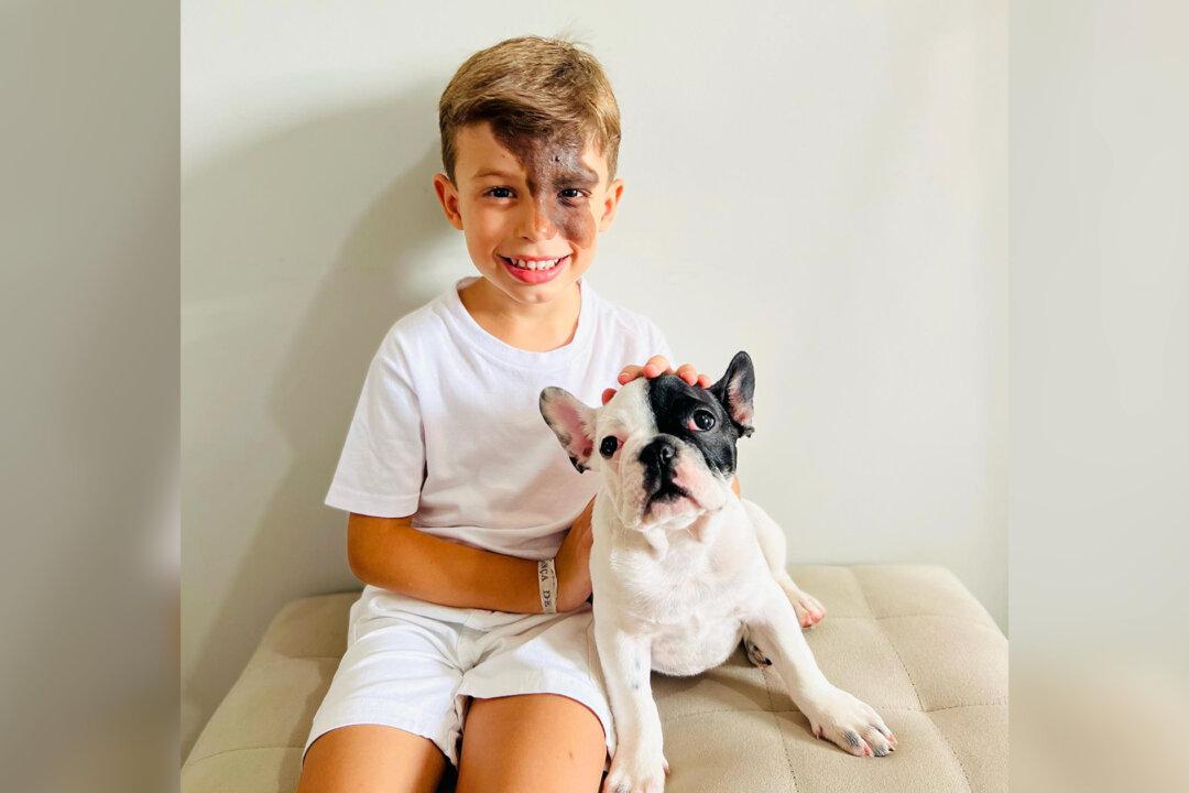 Parents Gift Son With a Unique Birthmark a Dog That Looks Exactly Like Him