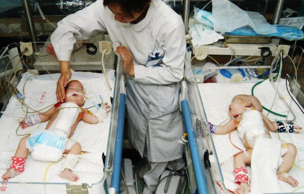 A nurse checks a pair of Siamese twins from Shanxi Province after their separation surgery June 1, 2005 at Xinhua Hospital in Shanghai, China. (China Photos/Getty Images)