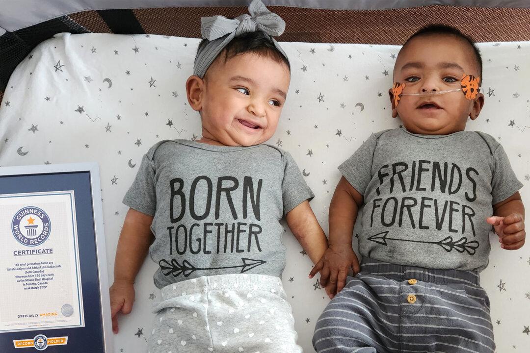 World’s Most Premature Twins Defy Doctors’ Zero Percent Chance Prognosis to Celebrate Their First Birthday