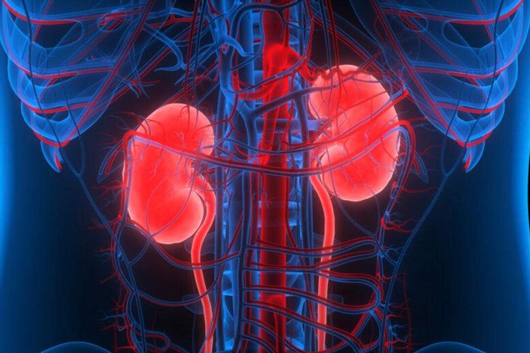 Natural Remedies for Kidney Stones, Prevention, and What Really Causes Them