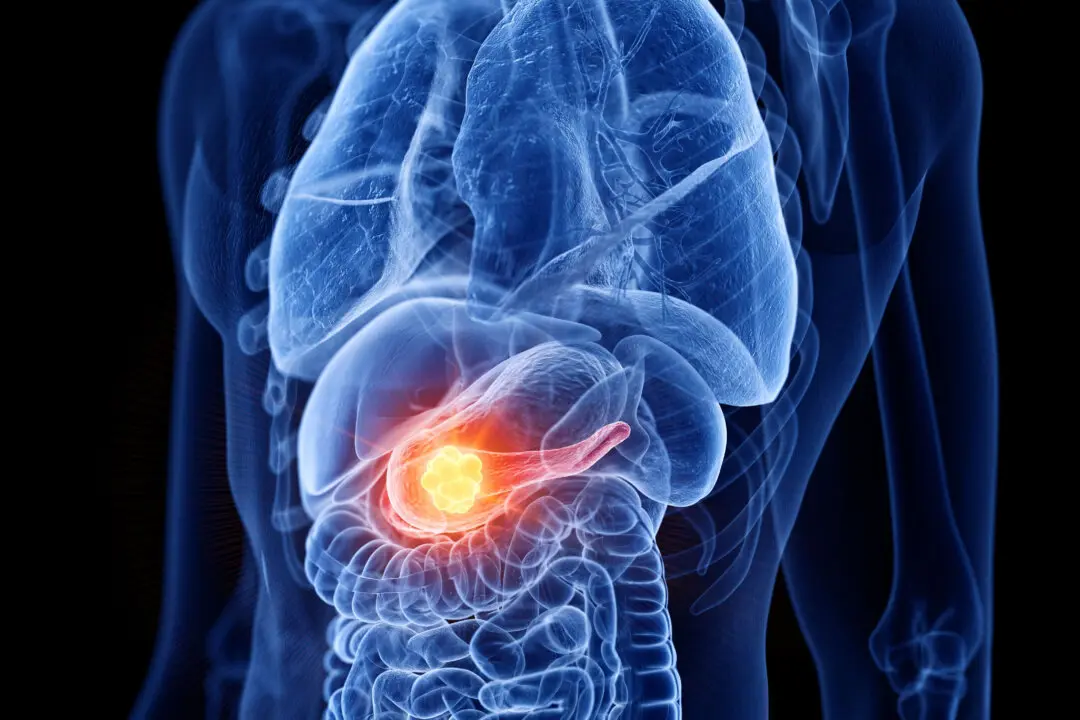 6 Daily Approaches to Preventing Pancreatic Cancer