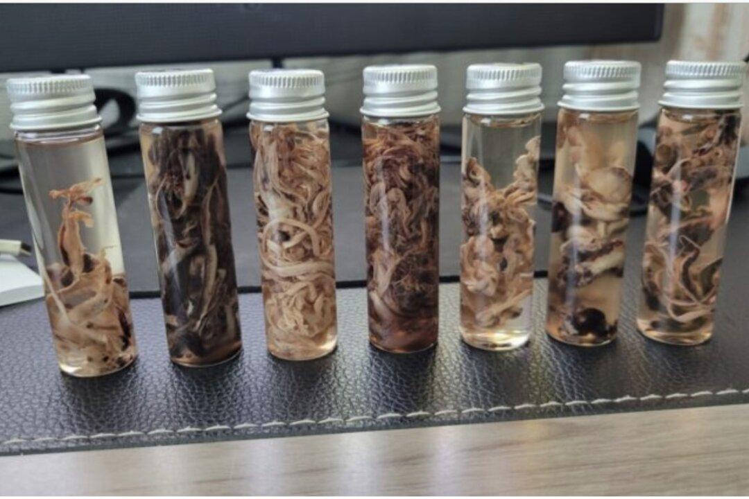 EXCLUSIVE: Embalmers Speak Out on Unusual Blood Clots