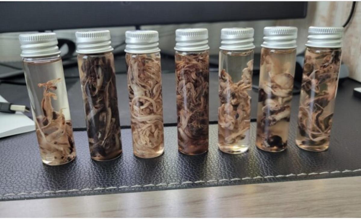 EXCLUSIVE: Embalmers Speak Out on Unusual Blood Clots