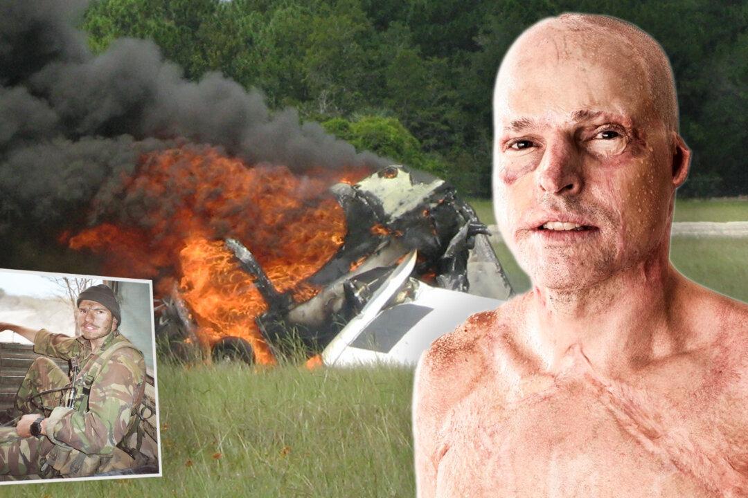 ‘Life on a Thread’: Pilot With 63 Percent Third-Degree Burns Survived His Cockpit Catching Fire