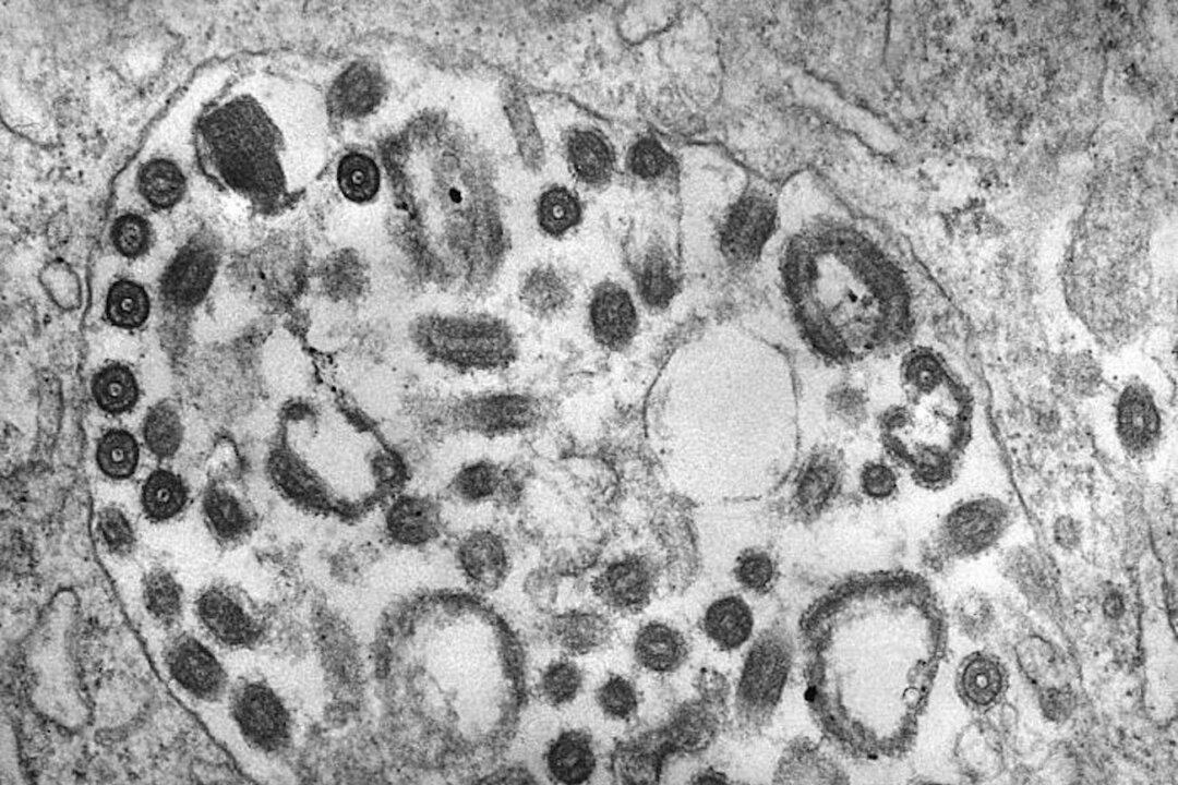 CDC Warns About Deadly Marburg Virus Amid Outbreaks in Africa