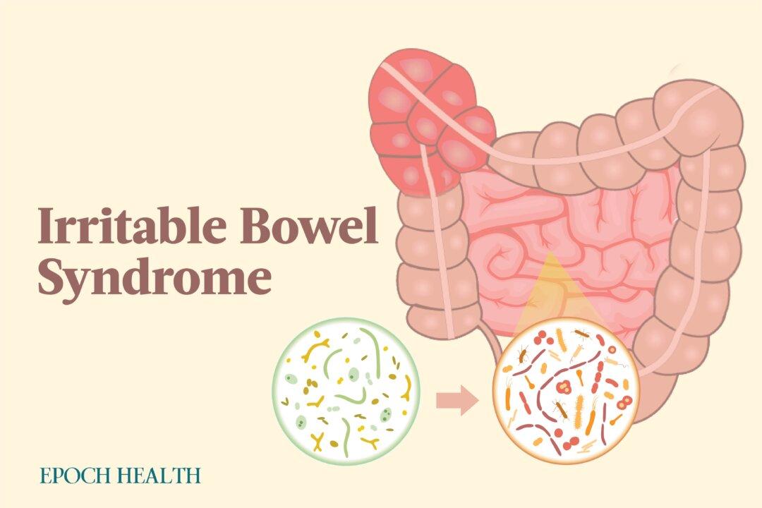 The Essential Guide to Irritable Bowel Syndrome (IBS): Symptoms, Causes, Treatments, and Natural Remedies