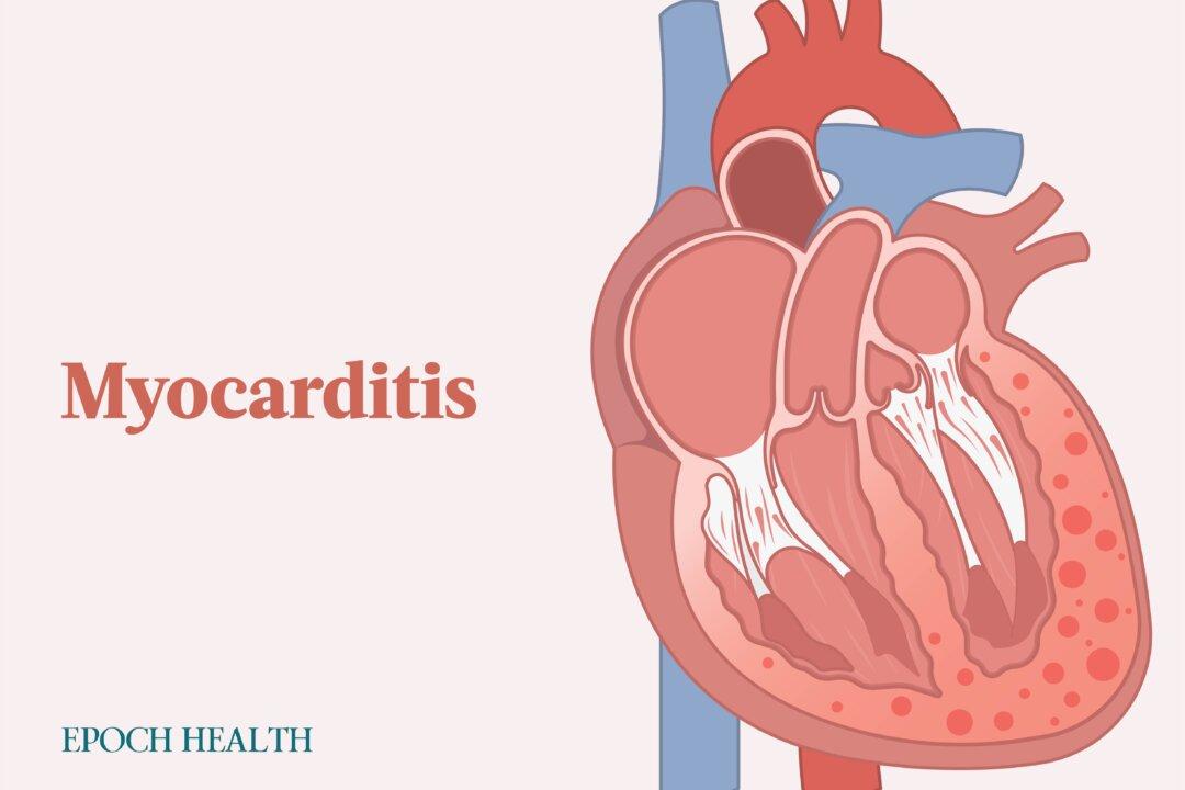 The Essential Guide to Myocarditis: Symptoms, Causes, Treatments, and Other Remedies