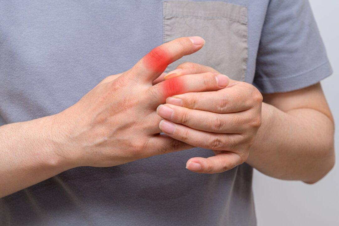 How to Cure Gout Naturally