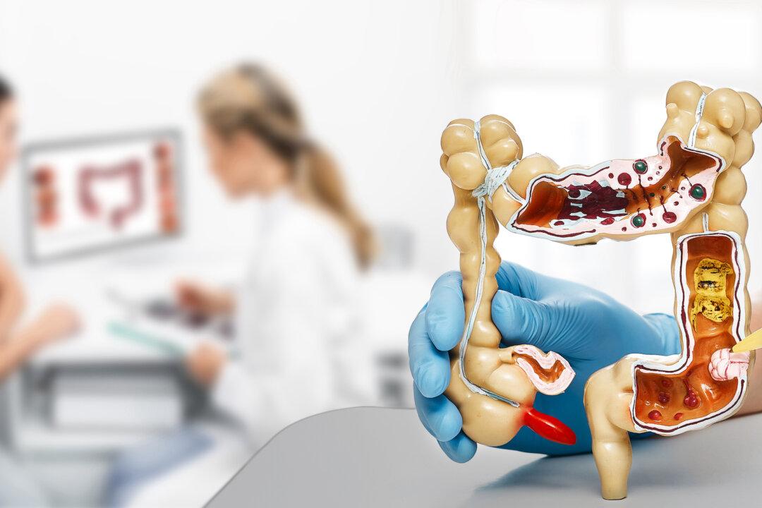 4 Red Flags Signal Early-Onset Colorectal Cancer Risk