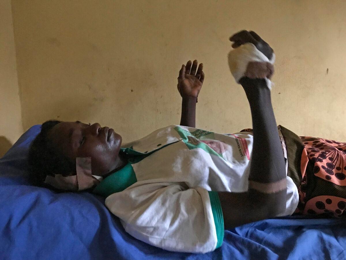 Ribal Danjuma, 26, had her ear and fingers cut off in an attack near Tattara village in Nigeria on April 28, 2023. (Masara Kim/The Epoch Times)
