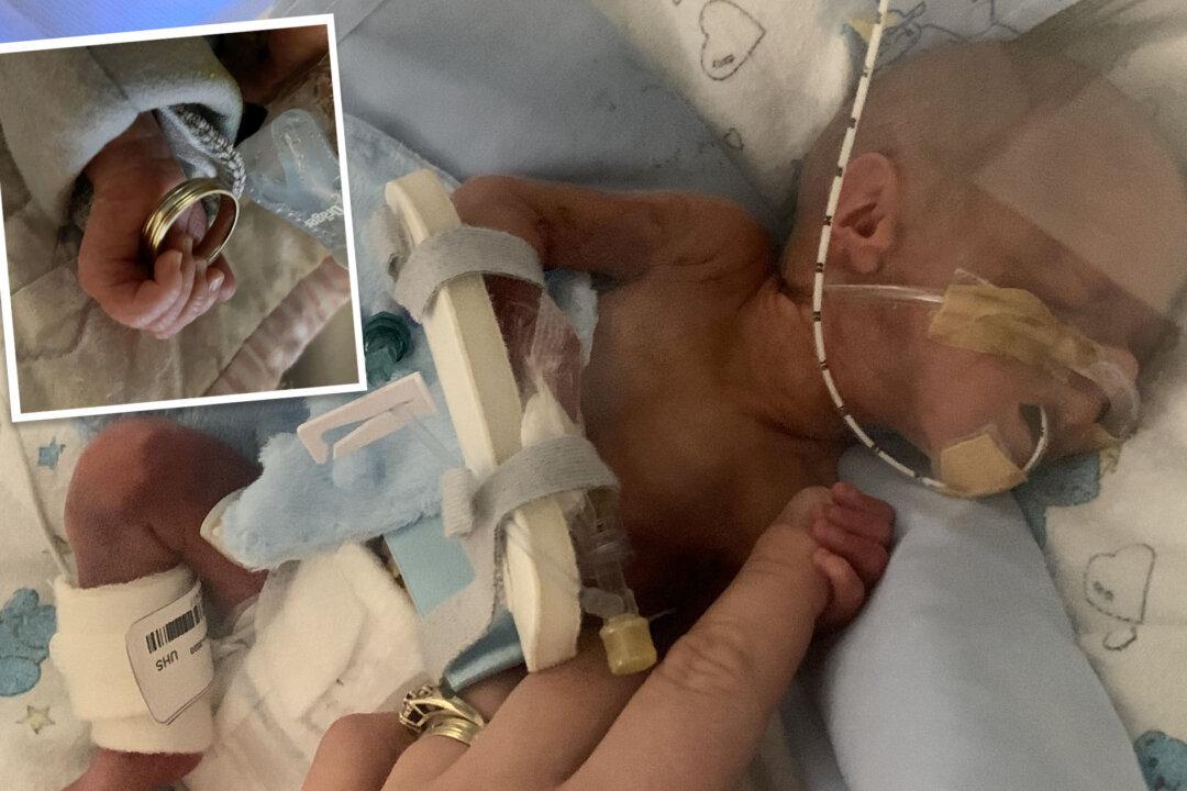 Premature Baby Whose Hand Was Smaller Than the Size of His Mom’s Wedding Ring Is Thriving