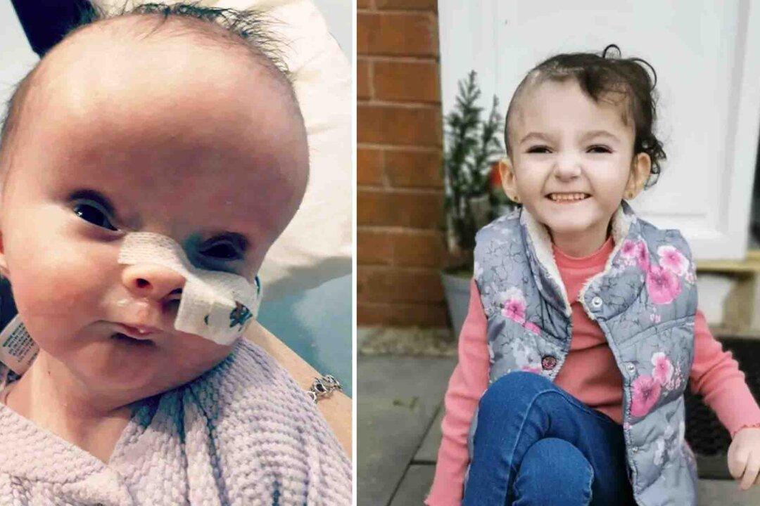 Baby Born With a Brain Condition That Made Her Head Swell Is Now 5 and Thriving