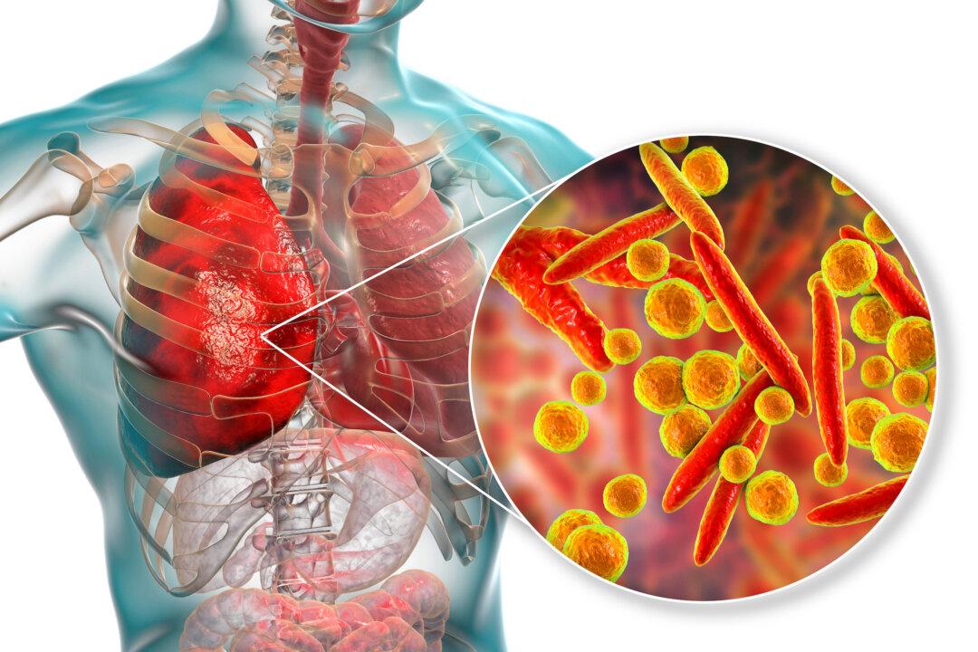 Majority of COVID Hospital Deaths Were Due to Untreated Bacterial Pneumonia