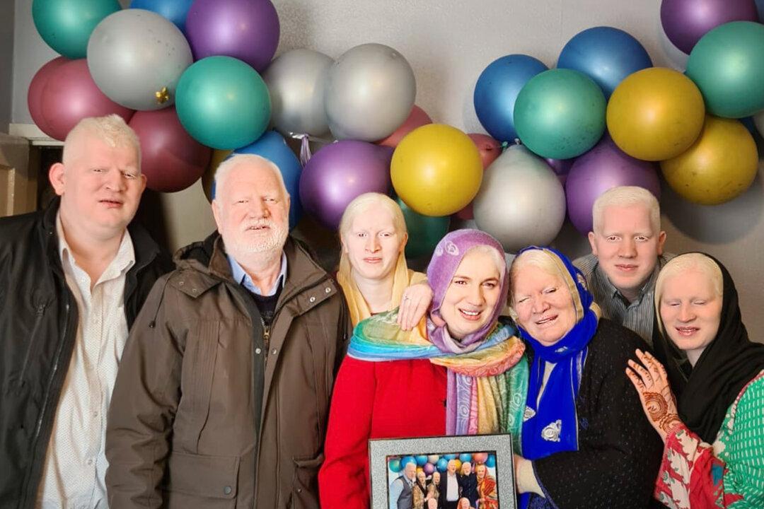 ‘I Like Who I Am’: Albino Asian Family With World Record for Most Albino Siblings Tells Their Story