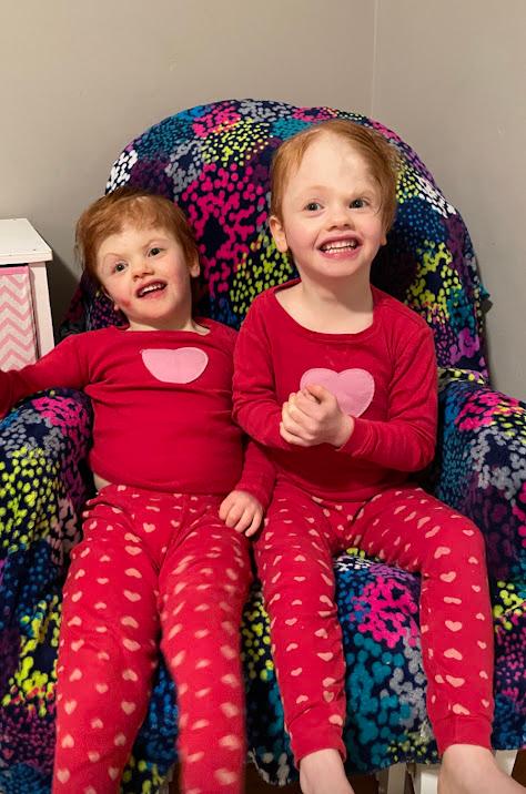 Twins Abby (left) and Erin (right). (SWNS)