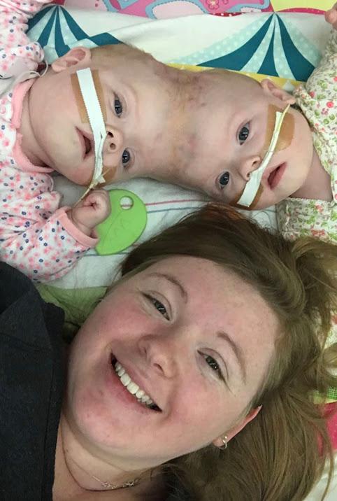 Ms. Delaney with Abby and Erin. (SWNS)
