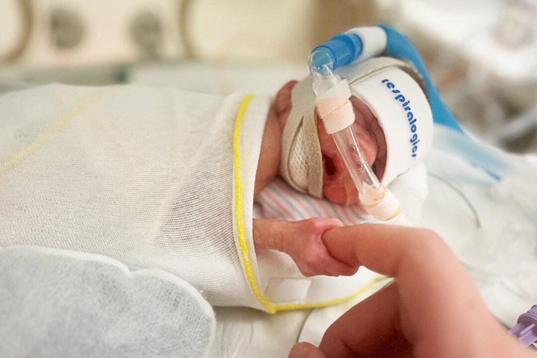 Tiny Baby Who Could Fit in Mom’s Hand Is Back Home, Thriving and Smiling After 181 Days in NICU