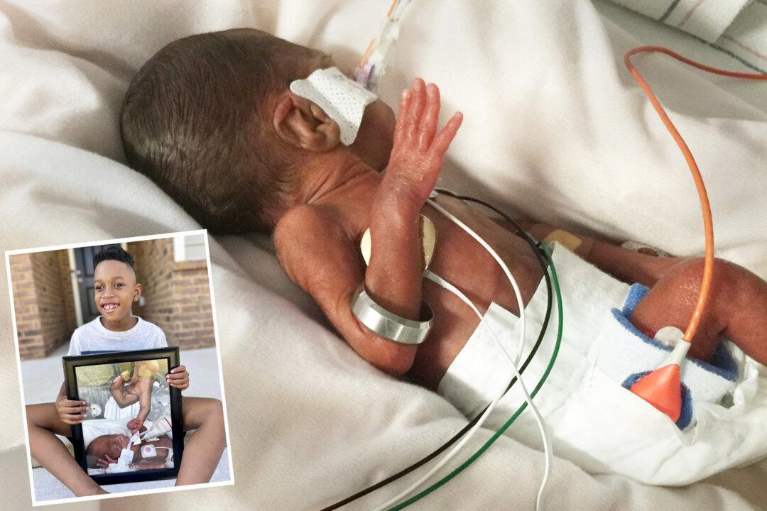 Baby Born at 22 Weeks Due to Mom’s Infection Is Now Thriving—He Was So Small He Could Wear Dad’s Wedding Ring as a Bracelet