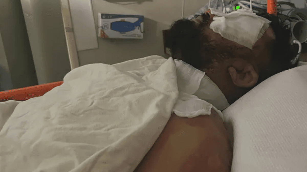 Store Clerk Set on Fire by Alleged Shoplifter in Northern California