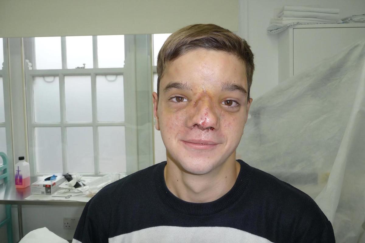 Stefan Savic after having his final operation in 2016. (Courtesy of Wayne Ingram)