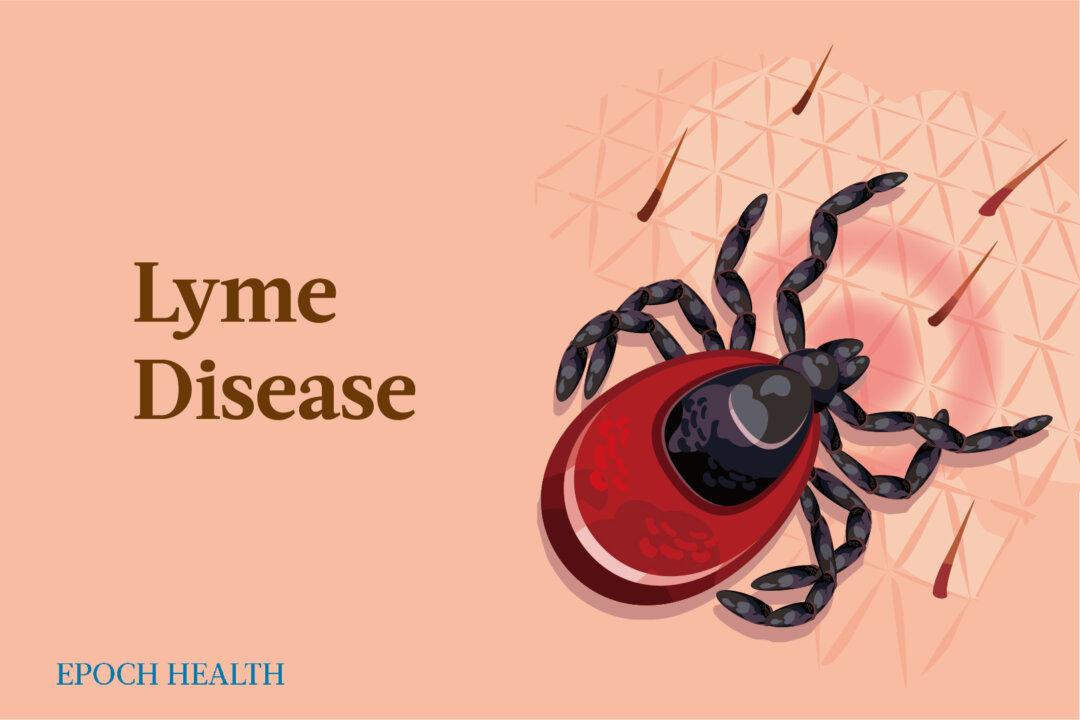 Lyme Disease: Symptoms, Causes, Treatments, and Natural Approaches