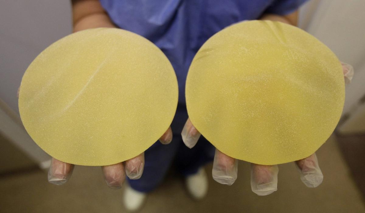 Create National Breast-Implant Registry to Help Prevent Complications: Committee