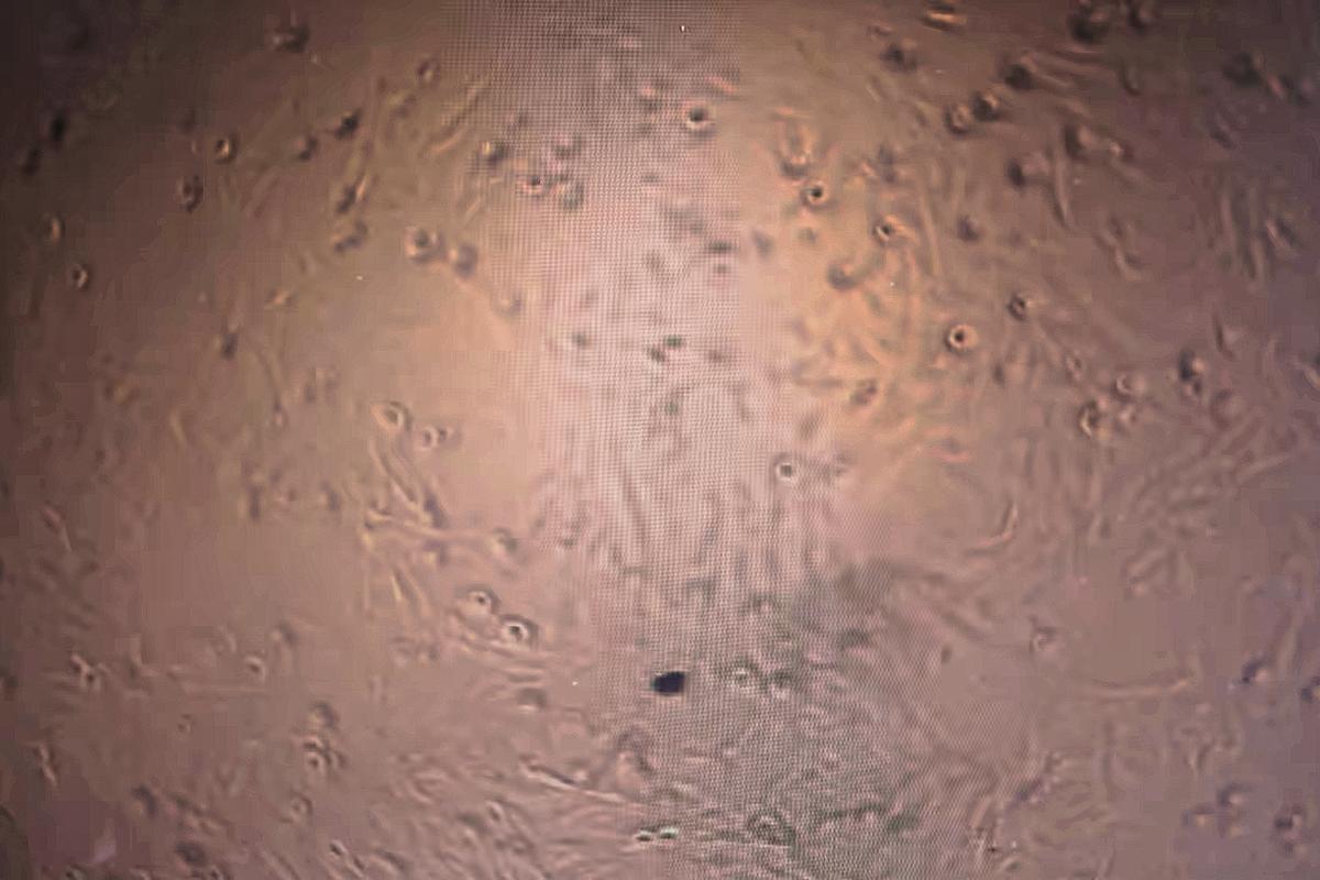 Animal cells are viewed under a microscope at the research lab of Yaakov Nahmias, founder of Believer Meats, at the Hebrew University of Jerusalem in Israel on Feb. 14, 2023. (AP Photo/Emma H. Tobin)