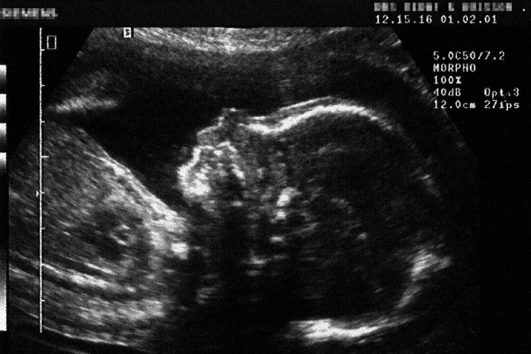 Unborn Protections Should at Least Match Those Given to Animals, Says Lord’s Bill