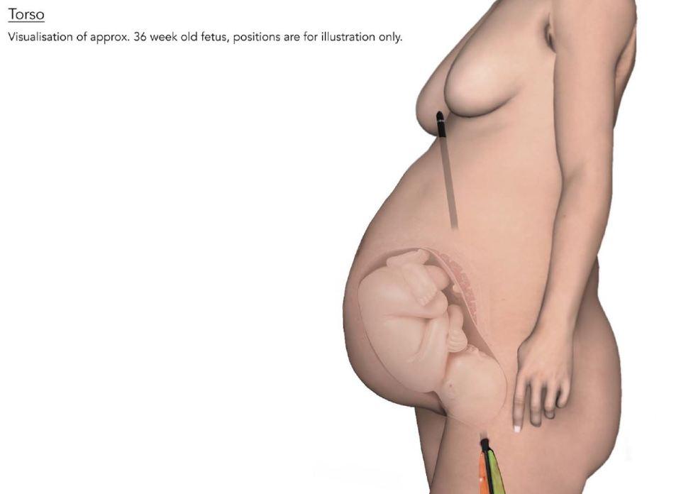 An undated graphic—shown to the jury at his murder trial—of the crossbow fired by Ramanodge Unmathallegadoo at his ex-wife, narrowly missing her unborn child. (Metropolitan Police)