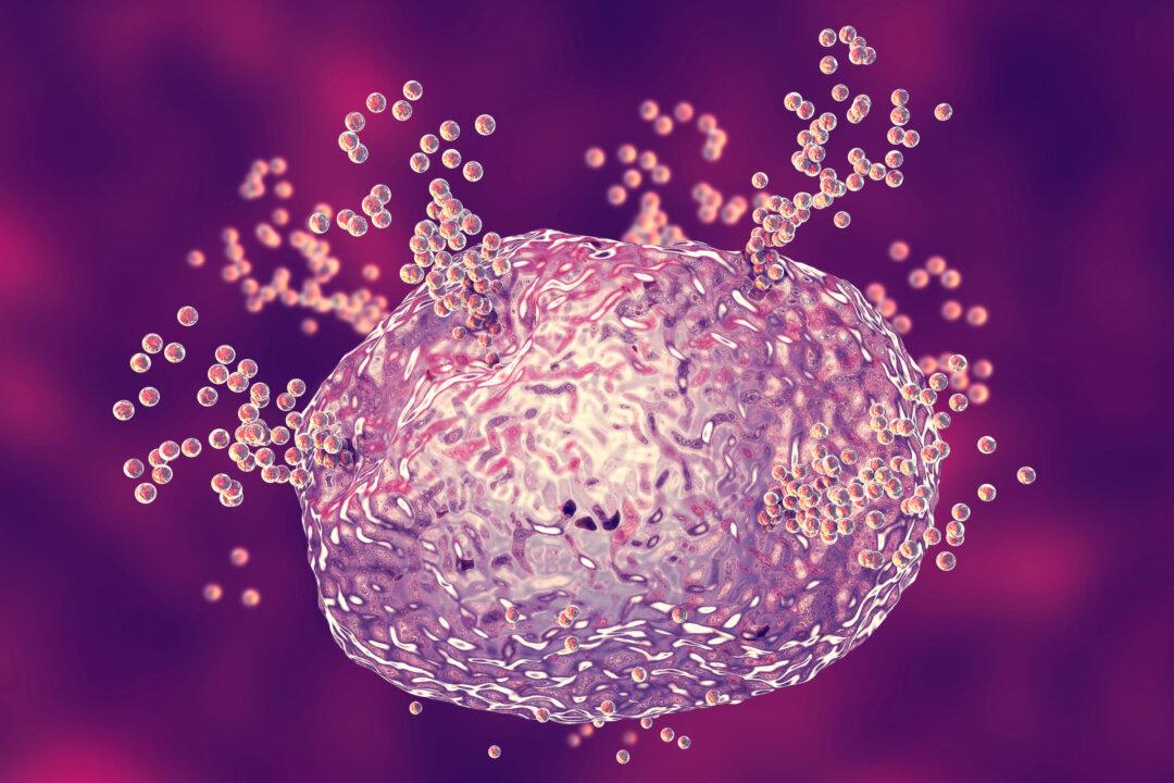 How to Diagnose Mast Cell Activation Syndrome