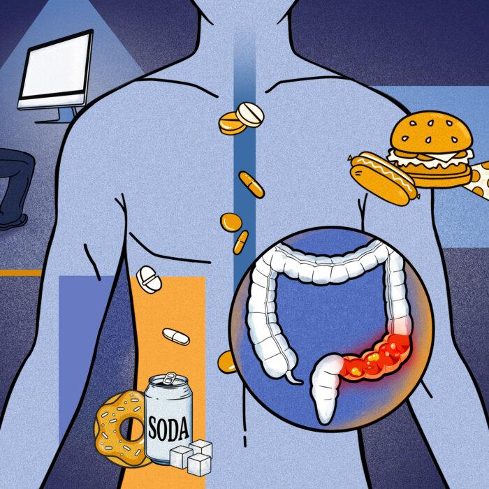Colorectal Cancer Is Striking Young People, and ‘Some New Exposures’ May Be Fueling It